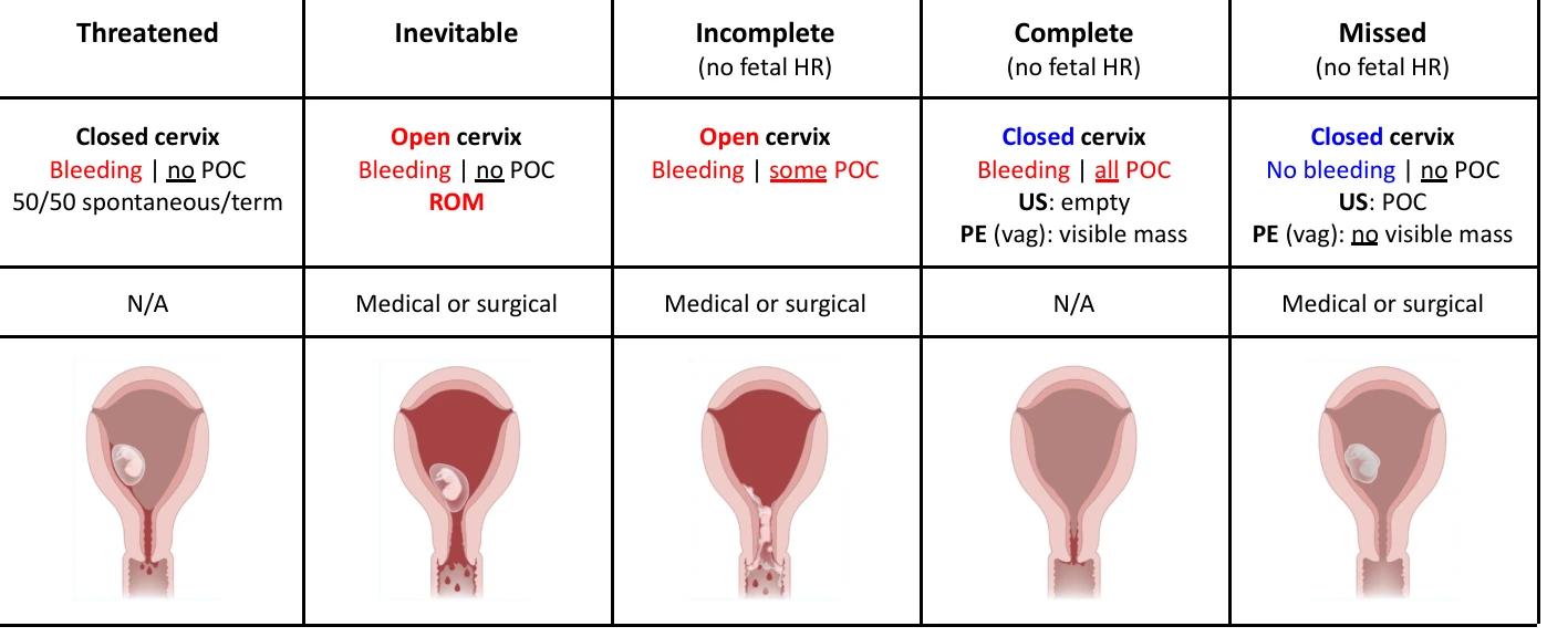 Phoebe's Obstetrics guide: five types of abortion side by side with uterus illustrations, open cervix in red and closed in blue